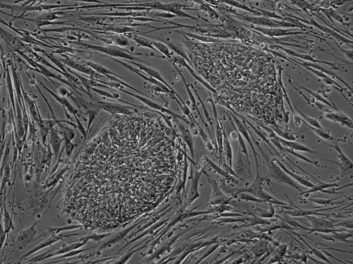 giant microbes stem cell
